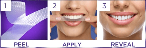 Crest 3D Whitestrips Professional Effects - Half Box (10 Treatments) - Smile Plug